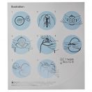 Калоприемник Coloplast Alterna 13191 стомический двухкомпонентный, пластина Long Wear фланец d60 мм 10-55 мм №5 в Украине foto 3
